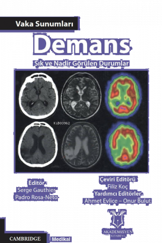 Demans - Vaka Sunumları - Sık ve Nadir Görülen Durumlar