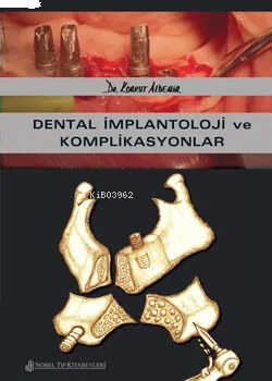 Dental İmplantoloji Ve Komplikasyonlar