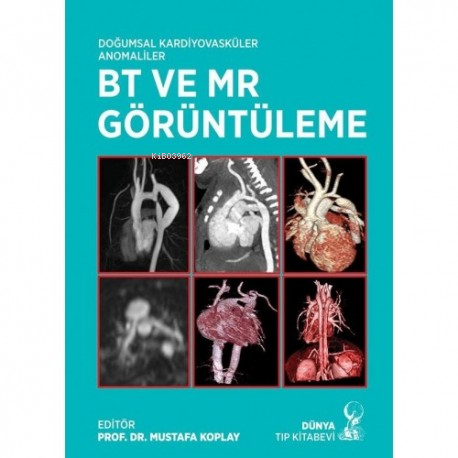 Doğumsal Kardiyovasküler Anamoliler Bt Ve Mrg Görüntüleme