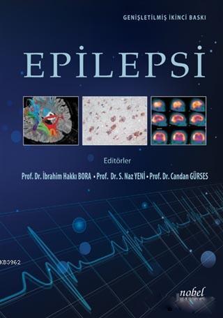 Epilepsi