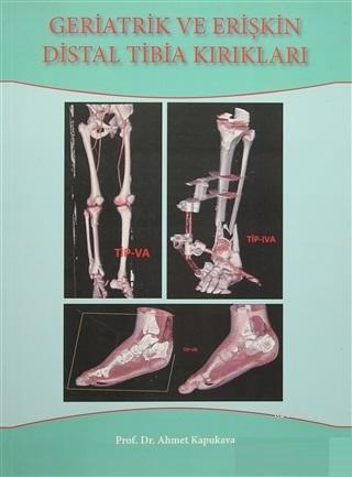 Geriatrik Ve Erişkin Distal Tibia Kırıkları