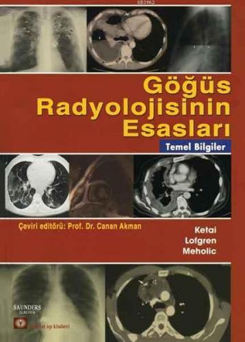 Göğüs Radyolojisinin Esasları