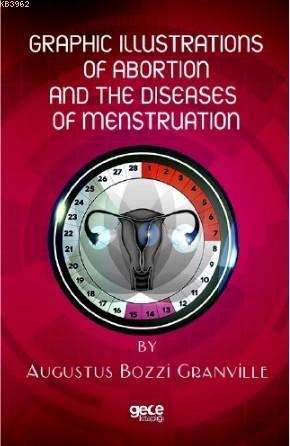 Graphic İllustrations Of Abortion And The Diseases Of Menstruation