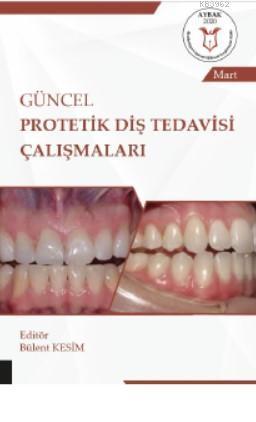 Güncel Protetik Diş Tedavisi Çalışmaları