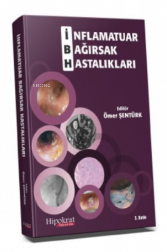 İnflamatuar Bağırsak Hastalıkları