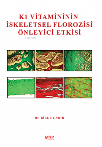 K1 Vitamininin İskeletsel Florozisi Önleyici Etkisi