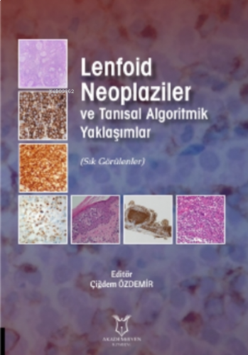 Lenfoid Neoplaziler ve Tanısal Algoritmik Yaklaşımlar