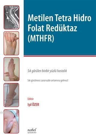 Metilen Tetra Hidro Folat Redüktaz (MTHFR)