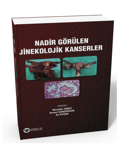 Nadir Görülen Jinekolojik Kanserler