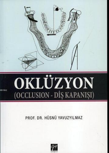 Oklüzyon