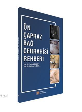 Ön Çapraz Bağ Cerrahisi Rehberi