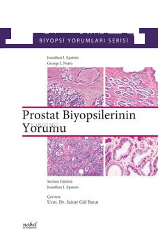 Prostat Biyopsilerinin Yorumu