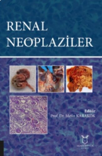 Renal Neoplaziler