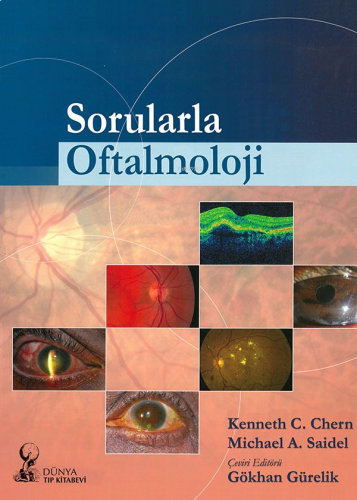 Sorularla Oftalmoloji