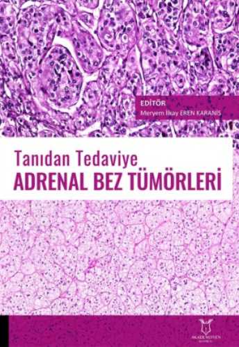 Tanıdan Tedaviye Adrenal Bez Tümörleri