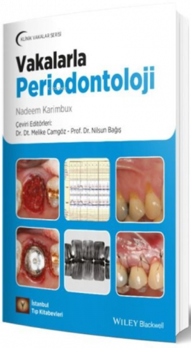 Vakalarla Periodontoloji