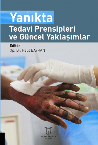 Yanıkta Tedavi Prensipleri ve Güncel Yaklaşımlar